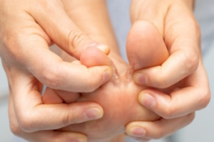 Interesting History of Athlete’s Foot